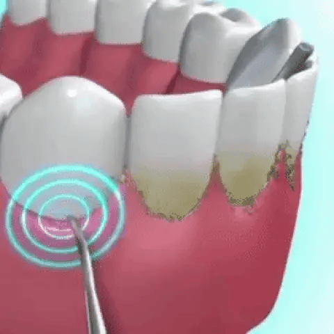 Irrigador Oral Bucal Recarregável Portátil - PowerJet